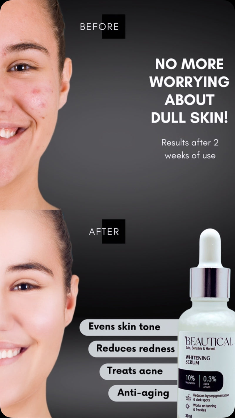 Beautical Whitening Serum (5 in 1 Formula)  Vitamin C + Niacinamide