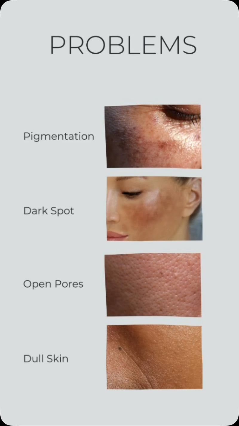 Beautical Whitening Serum (5 in 1 Formula)  Vitamin C + Niacinamide