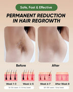 IPL Laser Hair Removal Device