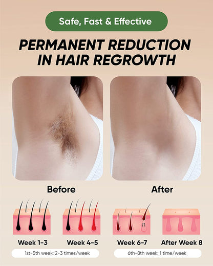 IPL Laser Hair Removal Device